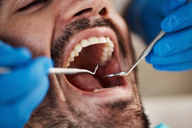 Best Same-Day Emergency Dentist in Mbria, CA